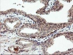 AGPAT5 Monoclonal Antibody (OTI2C4), TrueMAB , OriGene 30 &mu;L; Unconjugated:Antibodies,