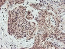 AGPAT5 Monoclonal Antibody (OTI2C4), TrueMAB , OriGene 30 &mu;L; Unconjugated:Antibodies,