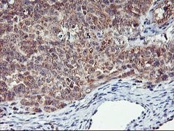 AGPAT5 Mouse anti-Human, Clone: OTI1D12, lyophilized, TrueMAB 100 &mu;g;