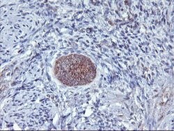 AGPAT5 Mouse anti-Human, Clone: OTI1D12, lyophilized, TrueMAB 100 &mu;g;
