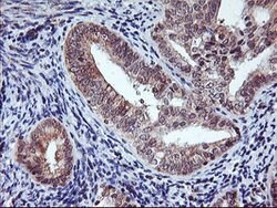 AGPAT5 Mouse anti-Human, Clone: OTI1D12, lyophilized, TrueMAB 100 &mu;g;
