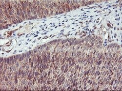 AGPAT5 Mouse anti-Human, Clone: OTI1D12, lyophilized, TrueMAB 100 &mu;g;