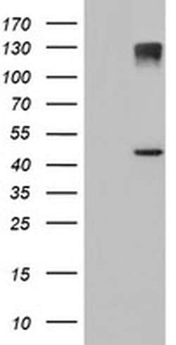 AGPAT5 Monoclonal Antibody (OTI1H10), TrueMAB , OriGene:Antibodies:Primary