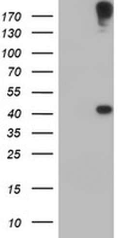 AGPAT5 Monoclonal Antibody (OTI2C4), TrueMAB , OriGene 30 &mu;L; Unconjugated:Antibodies,