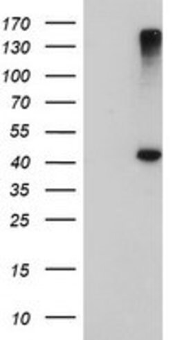 AGPAT5 Mouse anti-Human, Clone: OTI1D12, lyophilized, TrueMAB 100 &mu;g;