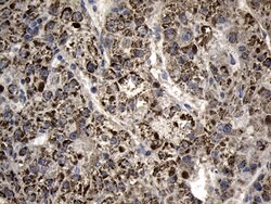 AGPAT9 Monoclonal Antibody (OTI6A3), TrueMAB , OriGene:Antibodies:Primary
