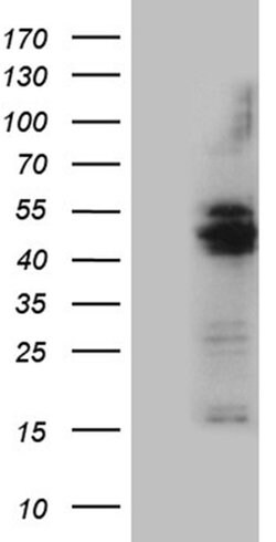 AGPAT9 Monoclonal Antibody (OTI6A3), TrueMAB , OriGene:Antibodies:Primary