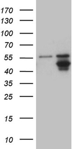 AGPAT9 Mouse anti-Human, Clone: OTI3G3, lyophilized, TrueMAB 100 &mu;g;