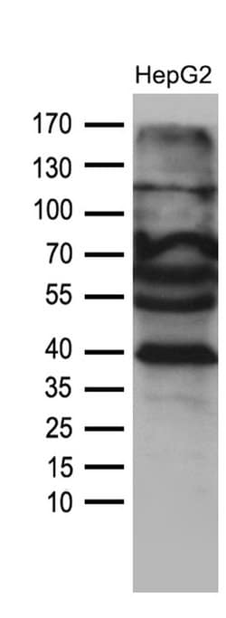 AGPAT9 Monoclonal Antibody (OTI1D4), TrueMAB , OriGene 100 &mu;L; Unconjugated:Antibodies,