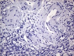 AGR2 Monoclonal Antibody (OTI3F2), TrueMAB , OriGene 100 &mu;L; Unconjugated:Antibodies,