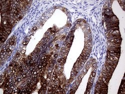 AGR2 Monoclonal Antibody (OTI3F2), TrueMAB , OriGene 100 &mu;L; Unconjugated:Antibodies,