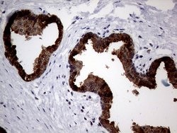 AGR2 Monoclonal Antibody (OTI3F2), TrueMAB , OriGene 100 &mu;L; Unconjugated:Antibodies,