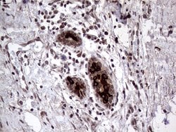 AGR2 Monoclonal Antibody (OTI5E10), TrueMAB , OriGene 100 &mu;L; Unconjugated:Antibodies,