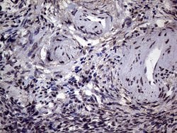 AGR2 Monoclonal Antibody (OTI5E10), TrueMAB , OriGene 100 &mu;L; Unconjugated:Antibodies,