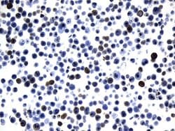 AGR2 Mouse anti-Human, Clone: UMAB245, liquid, UltraMAB 100 &mu;L; Unconjugated:Antibodies,