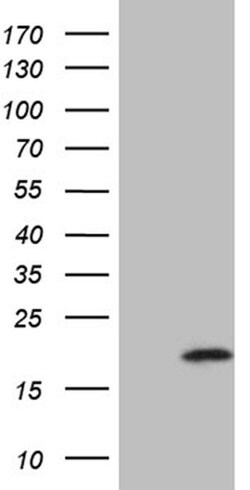 AGR2 Monoclonal Antibody (OTI3F2), TrueMAB , OriGene 100 &mu;L; Unconjugated:Antibodies,