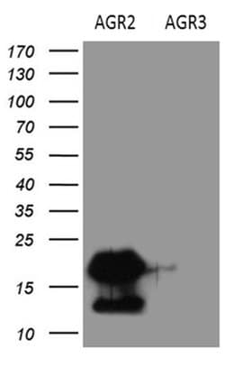 AGR2 Monoclonal Antibody (OTI5D8), TrueMAB , OriGene 100 &mu;L; Unconjugated:Antibodies,