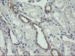 AGTPBP1 Monoclonal Antibody (OTI9A3), TrueMAB , OriGene 100 &mu;L; Unconjugated:Antibodies,