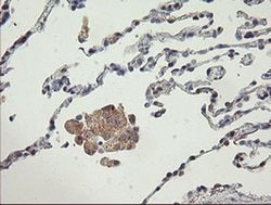 AGTPBP1 Monoclonal Antibody (OTI9A3), TrueMAB , OriGene 100 &mu;L; Unconjugated:Antibodies,