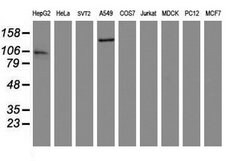 AGTPBP1 Mouse anti-Human, Clone: OTI9D11, lyophilized, TrueMAB 100 &mu;g;