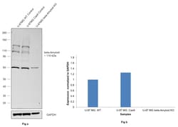 Invitrogen beta Amyloid (1-20) Monoclonal Antibody (7N22) 100 &mu;g; Unconjugated:Antibodies,