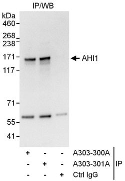 AHI1 Rabbit anti-Human, Polyclonal, Bethyl Laboratories 10 &mu;L; Unconjugated:Antibodies,