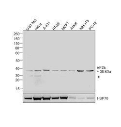 EIF2S1 Polyclonal Antibody, Invitrogen 100 &mu;g; Unconjugated:Antibodies,