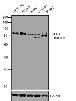 Invitrogen IGF1R beta Monoclonal Antibody (194Q13) 100 &mu;g | Buy Online | Invitrogen&trade; | Fisher Scientific