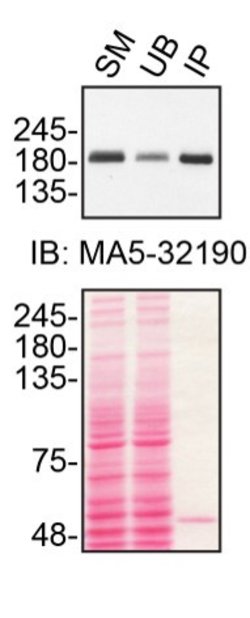 Invitrogen TSC2 Monoclonal Antibody (75R23) 100 &mu;g; Unconjugated:Antibodies,