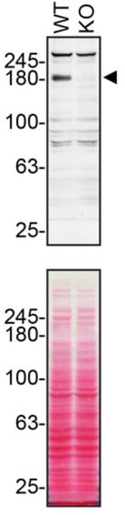 Invitrogen TSC2 Monoclonal Antibody (75R23) 100 &mu;g; Unconjugated:Antibodies,