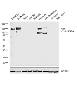 Invitrogen RET Monoclonal Antibody (421R25) 100 &mu;g; Unconjugated:Antibodies,