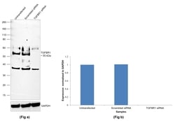 Invitrogen TGFBR1 Monoclonal Antibody (234R32) 100 &mu;g; Unconjugated:Antibodies,