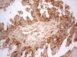 AHSA1 Mouse anti-Human, Clone: OTI1D2, lyophilized, TrueMAB 100 &mu;g;