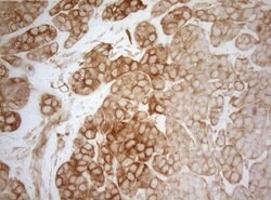 AHSA1 Mouse anti-Human, Clone: OTI1D2, lyophilized, TrueMAB 100 &mu;g;