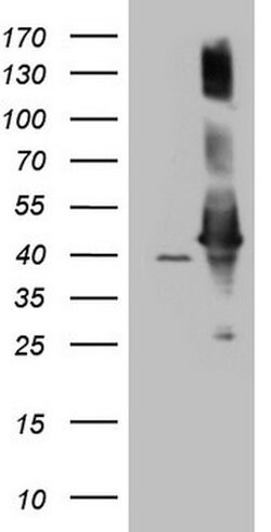 AHSA1 Mouse anti-Human, Clone: OTI1D2, lyophilized, TrueMAB 100 &mu;g;