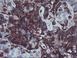 AHSG Mouse anti-Human, Clone: OTI2H2, lyophilized, TrueMAB 100 &mu;g; Unconjugated:Antibodies,