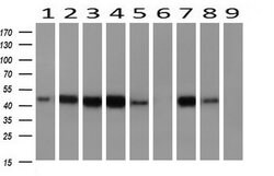 AHSG Mouse anti-Human, Clone: OTI2H2, lyophilized, TrueMAB 100 &mu;g; Unconjugated:Antibodies,