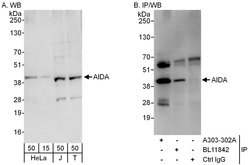AIDA Rabbit anti-Human, Polyclonal, Bethyl Laboratories 100 &mu;L | Buy Online | Bethyl Laboratories, Inc | Fisher Scientific
