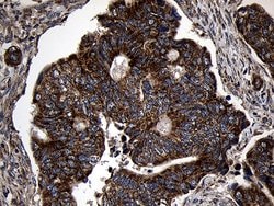 AIFM1 Monoclonal Antibody (OTI4E6), TrueMAB , OriGene 100 &mu;L; Unconjugated:Antibodies,