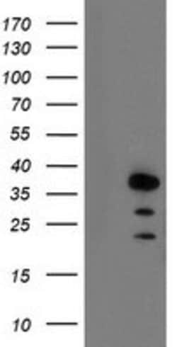AIP Mouse anti-Human, Clone: OTI1B6, lyophilized, TrueMAB 100 &mu;g; Unconjugated:Antibodies,