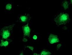 AIPL1 Monoclonal Antibody (OTI1B2), TrueMAB , OriGene:Antibodies:Primary