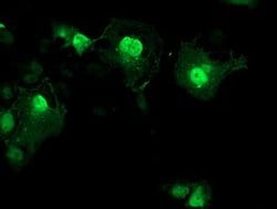 AIPL1 Monoclonal Antibody (OTI2D11), TrueMAB , OriGene 30 &mu;L; Unconjugated:Antibodies,