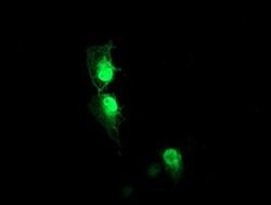 AIPL1 Monoclonal Antibody (OTI2B11), TrueMAB , OriGene 100 &mu;L; Unconjugated:Antibodies,