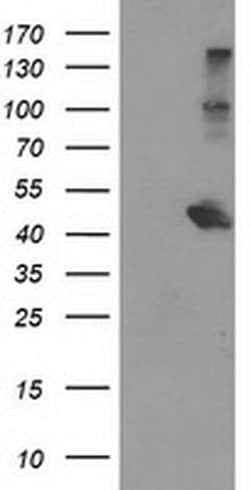 AIPL1 Monoclonal Antibody (OTI2D11), TrueMAB , OriGene:Antibodies:Primary