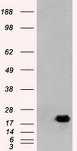 AK1 Mouse anti-Human, Clone: OTI19D1, liquid, TrueMAB 100 &mu;L; Unconjugated:Antibodies,