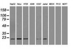 AK1 Mouse anti-Human, Clone: OTI19D1, liquid, TrueMAB 100 &mu;L; Unconjugated:Antibodies,
