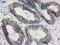 AK3 Monoclonal Antibody (OTI5A1), TrueMAB , OriGene 30 &mu;L; Unconjugated:Antibodies,