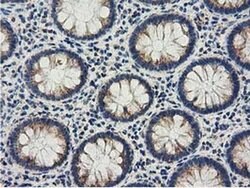 AK3 Monoclonal Antibody (OTI3G1), TrueMAB , OriGene 100 &mu;L; Unconjugated:Antibodies,