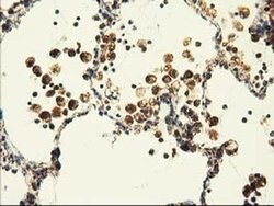 AK3 Monoclonal Antibody (OTI6B7), TrueMAB , OriGene 100 &mu;L; Unconjugated:Antibodies,