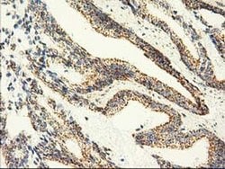 AK3 Monoclonal Antibody (OTI6B7), TrueMAB , OriGene 100 &mu;L; Unconjugated:Antibodies,
